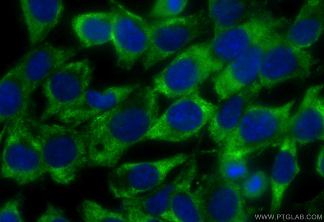 EXOC1 Antibody in Immunocytochemistry (ICC/IF)