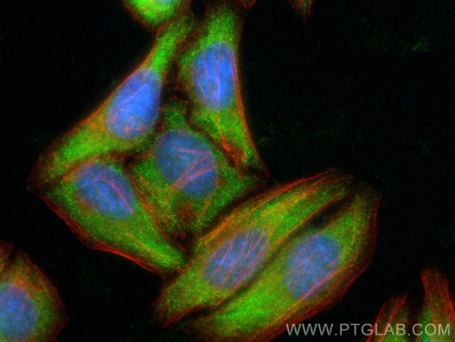 HMGN1 Antibody in Immunocytochemistry (ICC/IF)