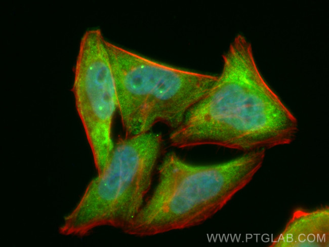 SMN Antibody in Immunocytochemistry (ICC/IF)