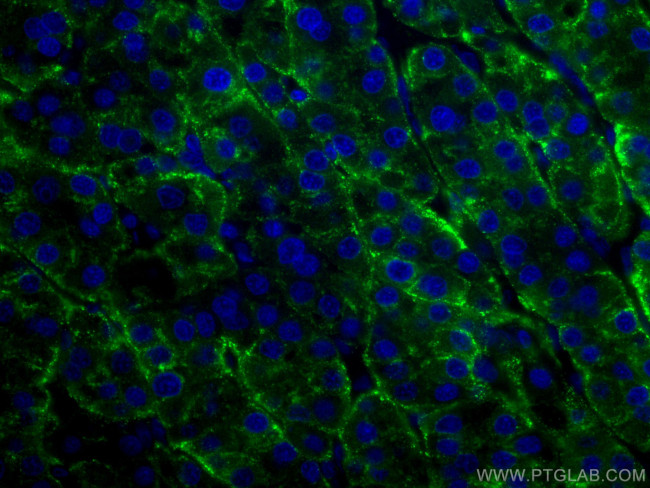ASGR1 Antibody in Immunohistochemistry (PFA fixed) (IHC (PFA))