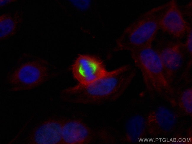 TPX2 Antibody in Immunocytochemistry (ICC/IF)