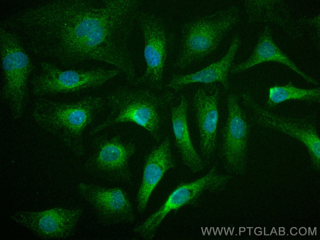 PKIA Antibody in Immunocytochemistry (ICC/IF)