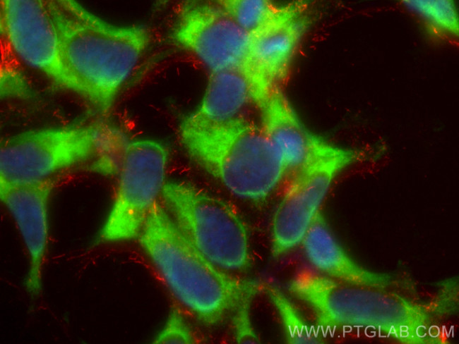 CACYBP Antibody in Immunocytochemistry (ICC/IF)
