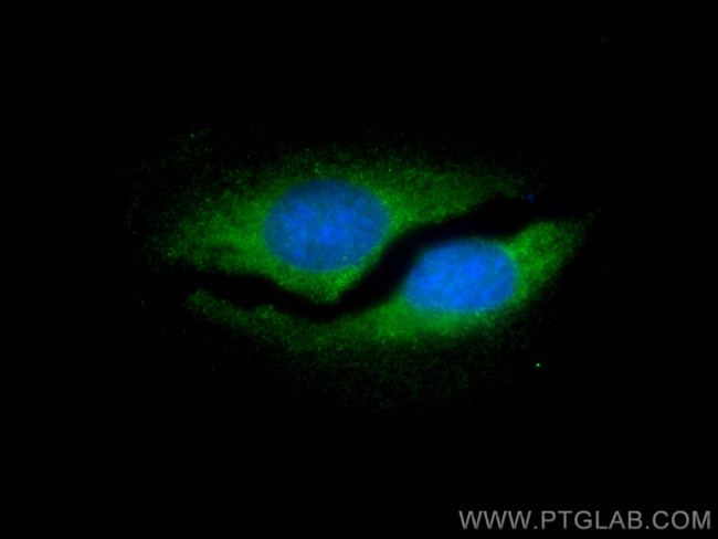 PSMB1 Antibody in Immunocytochemistry (ICC/IF)