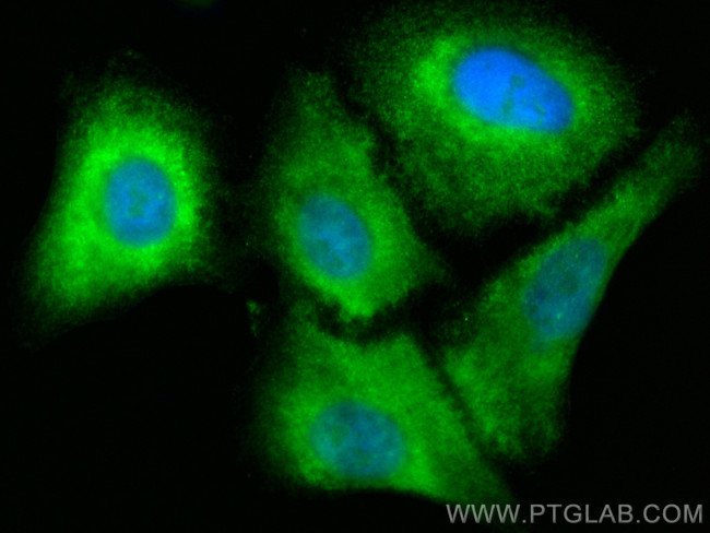 DIO1 Antibody in Immunocytochemistry (ICC/IF)