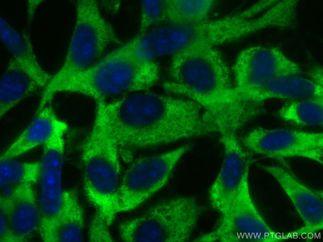 RAB10 Antibody in Immunocytochemistry (ICC/IF)
