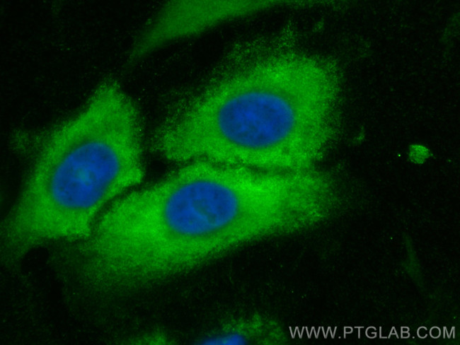 RABL3 Antibody in Immunocytochemistry (ICC/IF)