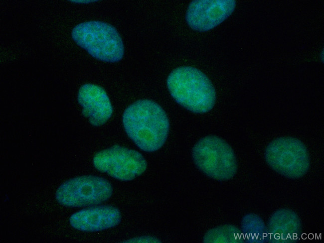 HELLS Antibody in Immunocytochemistry (ICC/IF)