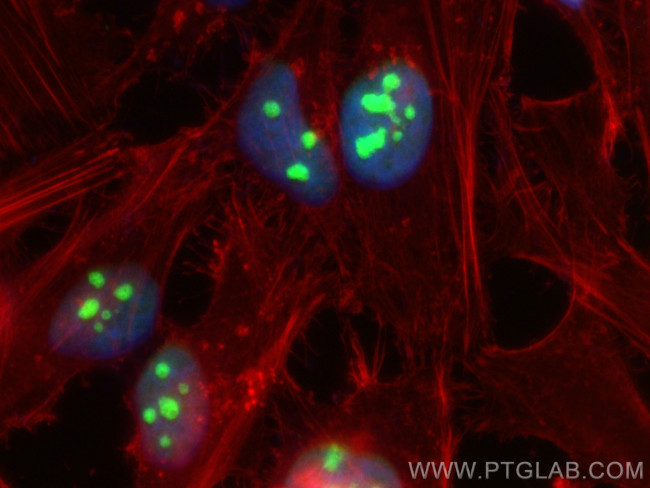 EMG1 Antibody in Immunocytochemistry (ICC/IF)