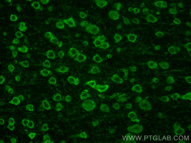 Galc Antibody in Immunohistochemistry (Paraffin) (IHC (P))