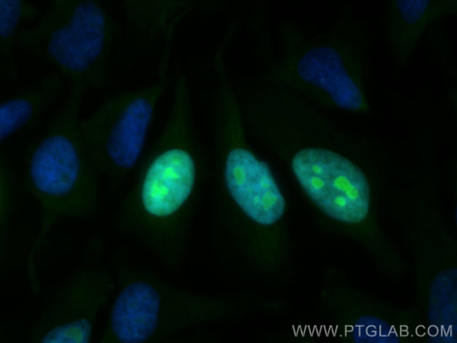 NUSAP1 Antibody in Immunocytochemistry (ICC/IF)