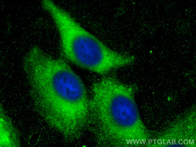 DVL2 Antibody in Immunocytochemistry (ICC/IF)