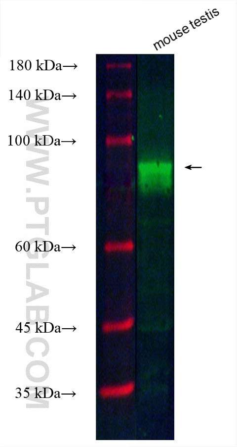 ODF2 Antibody in Western Blot (WB)