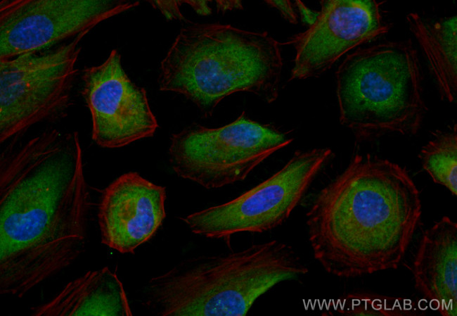 KRAS Antibody in Immunocytochemistry (ICC/IF)