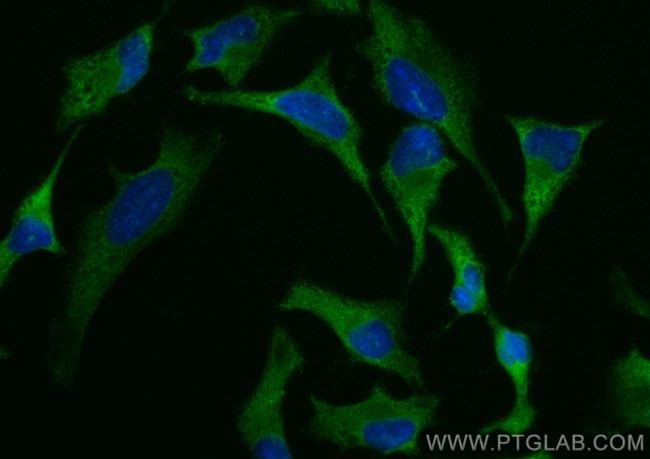 UBA5 Antibody in Immunocytochemistry (ICC/IF)