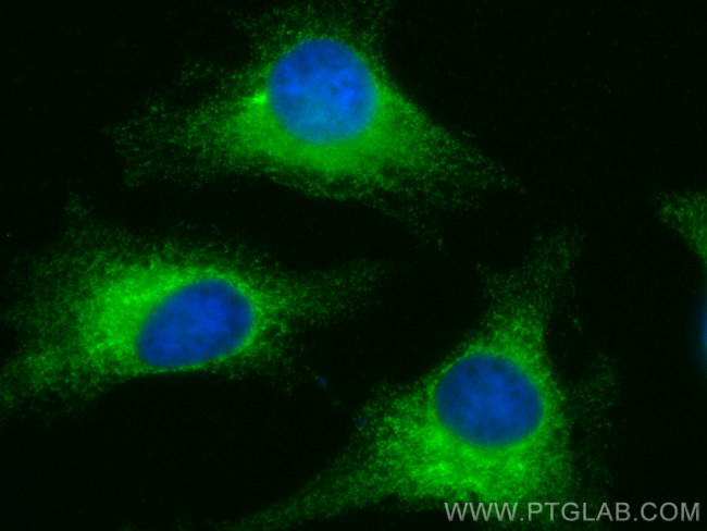 PRKCSH Antibody in Immunocytochemistry (ICC/IF)