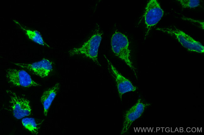 OXCT1 Antibody in Immunocytochemistry (ICC/IF)