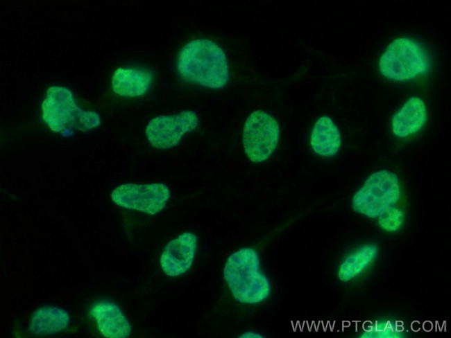 MATR3 Antibody in Immunocytochemistry (ICC/IF)