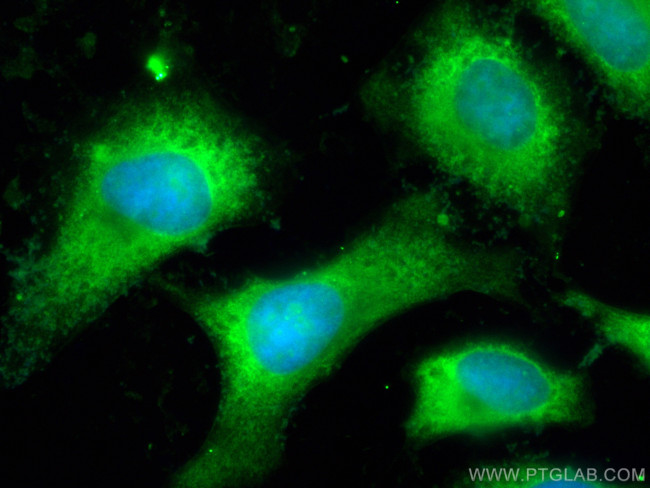 BMP7 Antibody in Immunocytochemistry (ICC/IF)