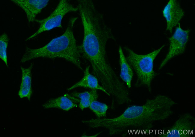 NDP52 Antibody in Immunocytochemistry (ICC/IF)