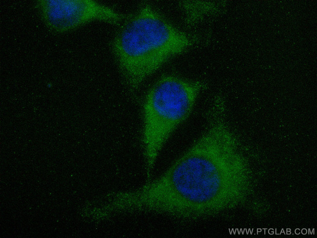 PRKACB Antibody in Immunocytochemistry (ICC/IF)