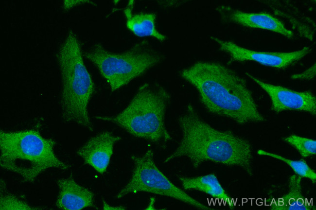 Cystatin C Antibody in Immunocytochemistry (ICC/IF)
