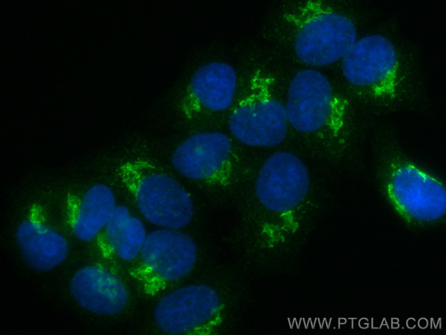 RCAS1 Antibody in Immunocytochemistry (ICC/IF)