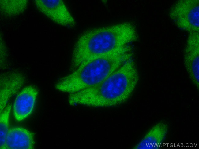 SERPING1/C1 Inactivator Antibody in Immunocytochemistry (ICC/IF)
