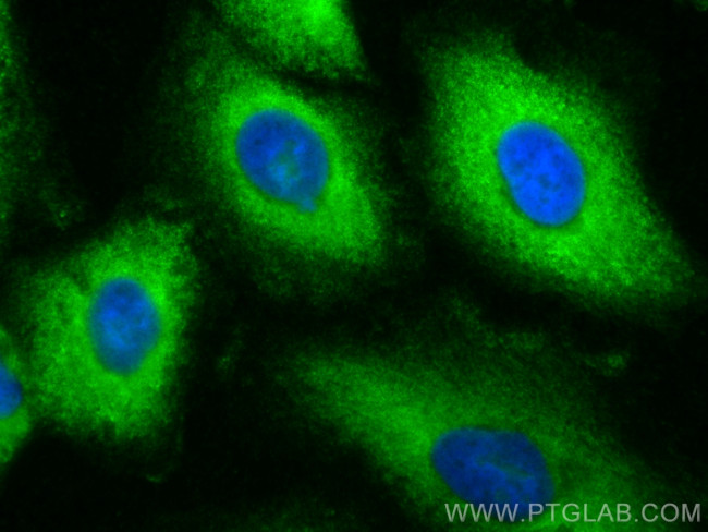 CYP4F11 Antibody in Immunocytochemistry (ICC/IF)