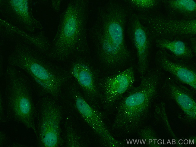 Clusterin Antibody in Immunocytochemistry (ICC/IF)