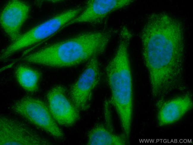Neurotrophin 4 Antibody in Immunocytochemistry (ICC/IF)