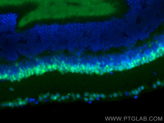 PAX6 Antibody in Immunohistochemistry (Paraffin) (IHC (P))