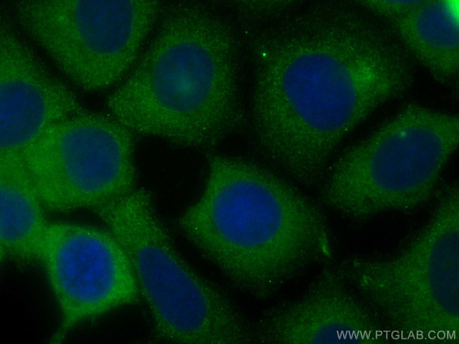 DYNC1H1 Antibody in Immunocytochemistry (ICC/IF)