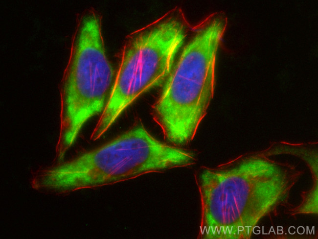 MAGEB1 Antibody in Immunocytochemistry (ICC/IF)