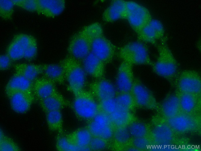 HOMER1 Antibody in Immunocytochemistry (ICC/IF)