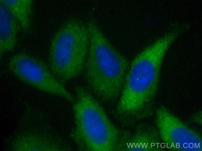 SHC Antibody in Immunocytochemistry (ICC/IF)