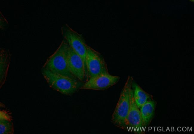 CHMP2B Antibody in Immunocytochemistry (ICC/IF)