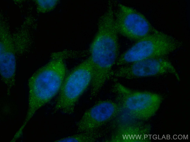 SQLE Antibody in Immunocytochemistry (ICC/IF)