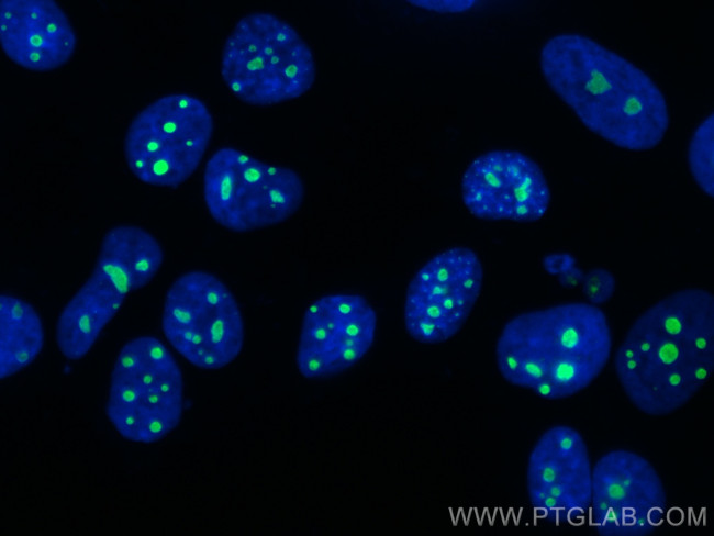 NIFK Antibody in Immunocytochemistry (ICC/IF)