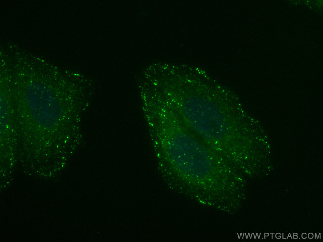 APPL1 Antibody in Immunocytochemistry (ICC/IF)
