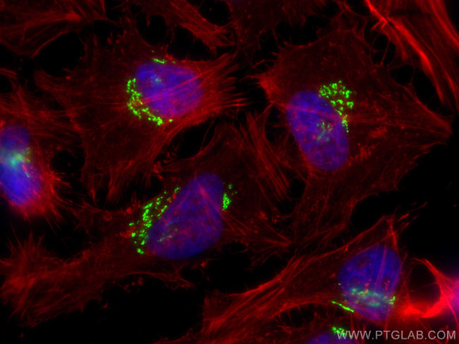golgin 97 Antibody in Immunocytochemistry (ICC/IF)