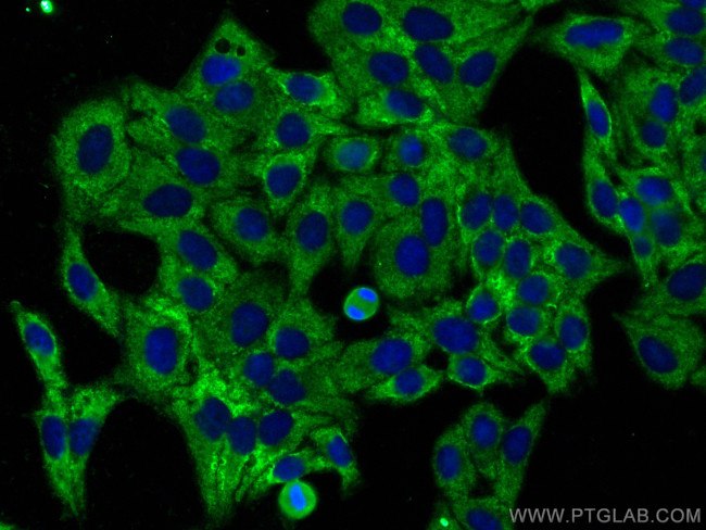 Osteoglycin Antibody in Immunocytochemistry (ICC/IF)
