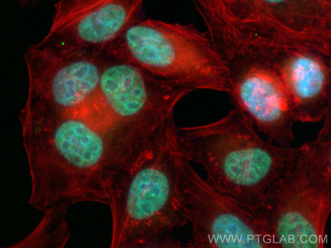 HNRNPD Antibody in Immunocytochemistry (ICC/IF)