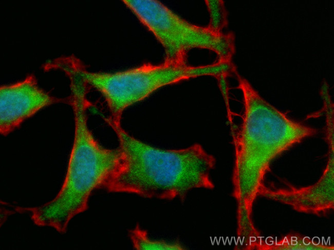 HSPA2 Antibody in Immunocytochemistry (ICC/IF)