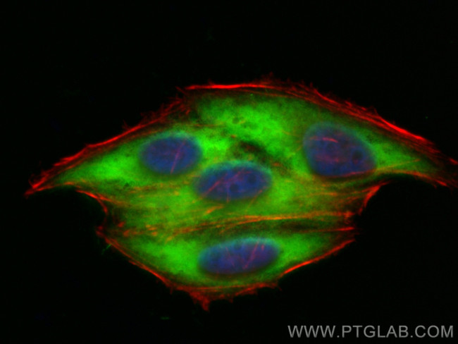 SECISBP2 Antibody in Immunocytochemistry (ICC/IF)