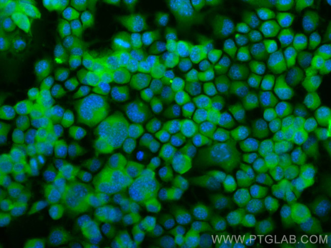 BACE1 Antibody in Immunocytochemistry (ICC/IF)