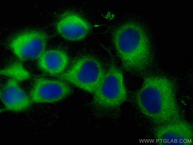 PLS3 Antibody in Immunocytochemistry (ICC/IF)