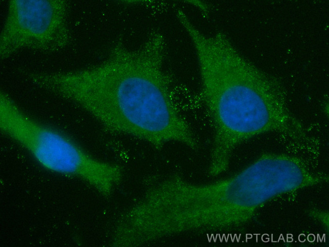 RASGAP Antibody in Immunocytochemistry (ICC/IF)