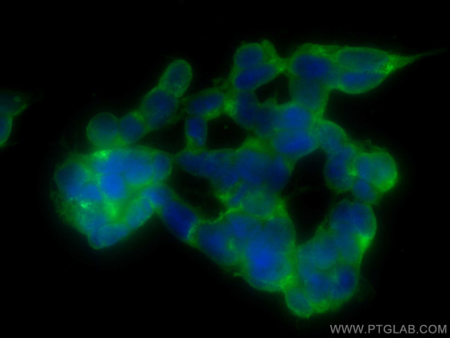 NF-L Antibody in Immunocytochemistry (ICC/IF)