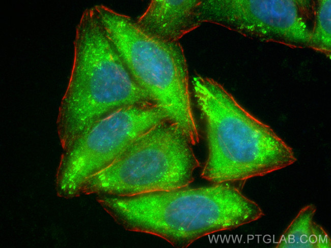 HIP55 Antibody in Immunocytochemistry (ICC/IF)